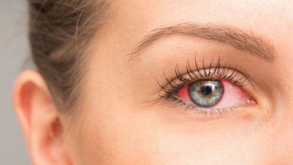 có nên đeo kính áp tròng đi bơi