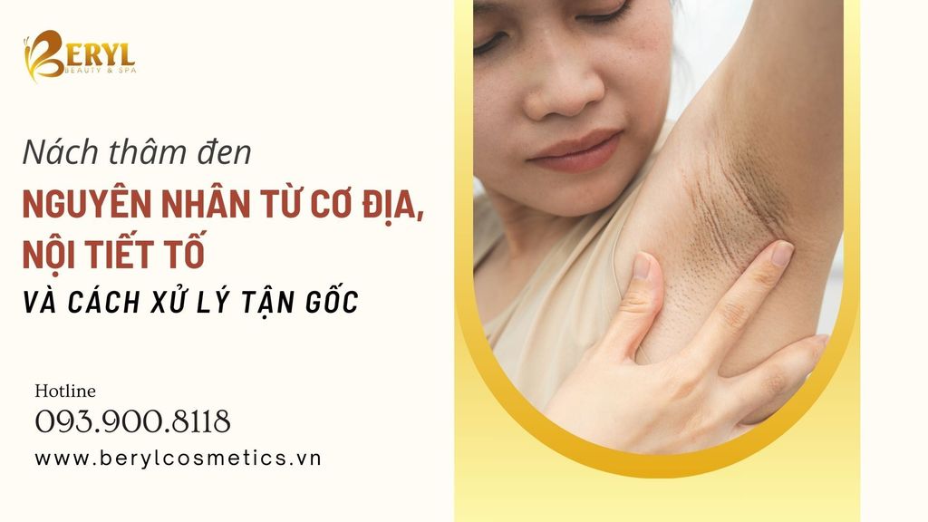 Nách thâm đen: Nguyên nhân từ cơ địa, nội tiết tố và cách xử lý tận gốc