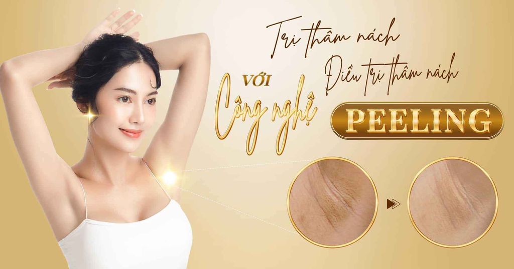 Trị thâm nách với công nghệ Peeling