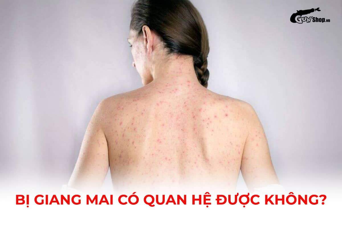 Bị giang mai có quan hệ được không?