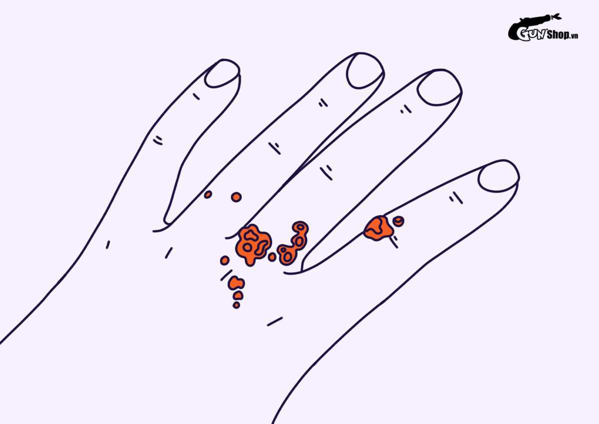 Chưa quan hệ có bị nhiễm HPV không?