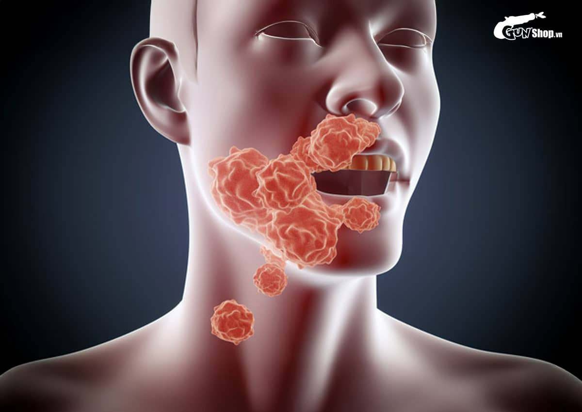 Súc miệng bằng nước muối sau khi quan hệ bằng miệng có tác dụng gì?