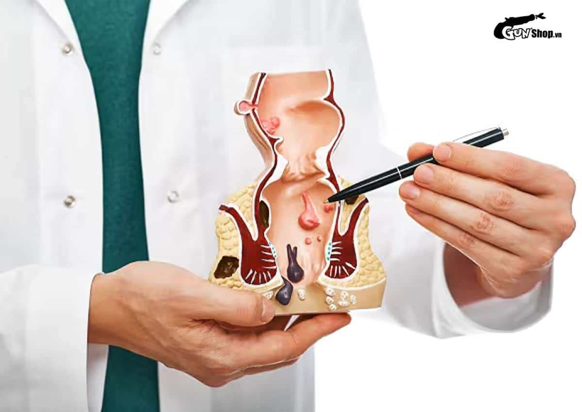Sau mổ trĩ kiêng quan hệ bao lâu?