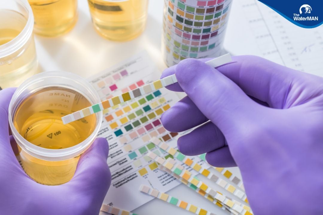 Nhận biết việc mất nước thông qua màu nước tiểu