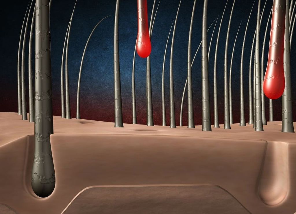 Nang tóc yếu là nguyên nhân hàng đầu khiến tóc rụng