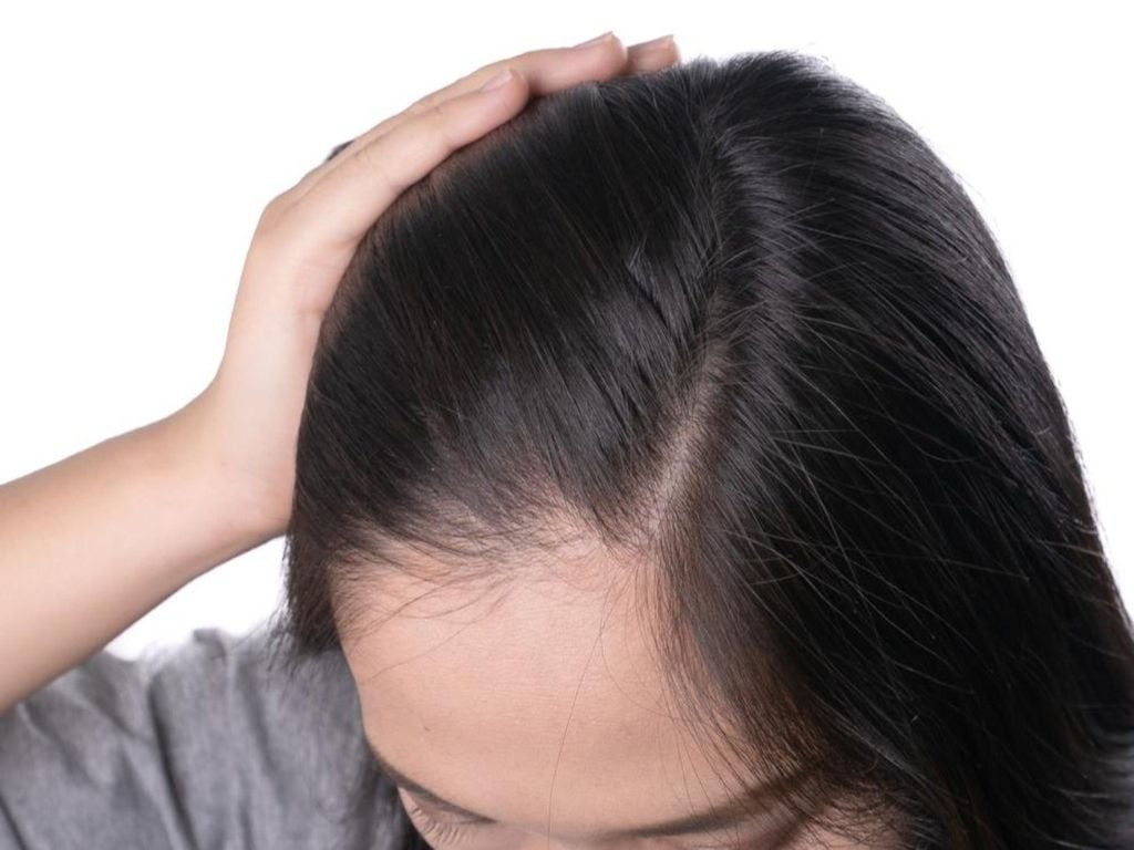 Kết hợp chế độ ăn uống, sinh hoạt và dưỡng tóc giúp tóc mọc tốt hơn