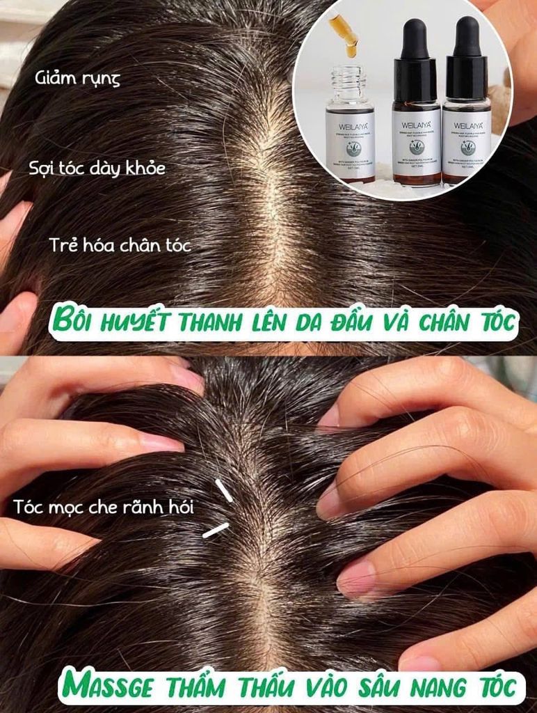Serum hỗ trợ mọc và làm dày tóc Weilaiya hỗ trợ làm trẻ nang tóc