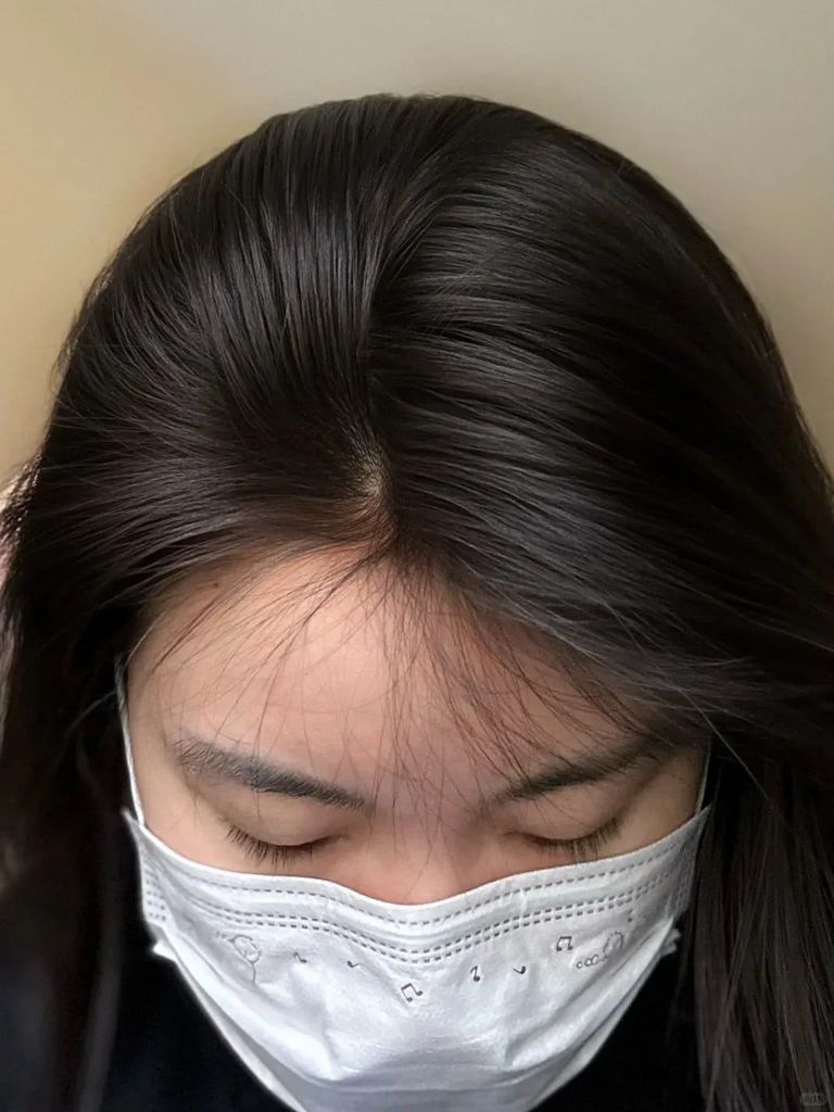 Tóc mọc dày và đẹp sau khi kiên trì áp dụng các biện pháp chăm sóc tóc