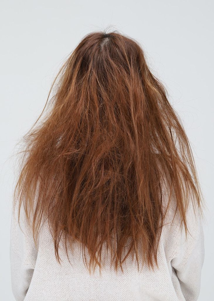 Tóc bị xơ rối mất độ bóng