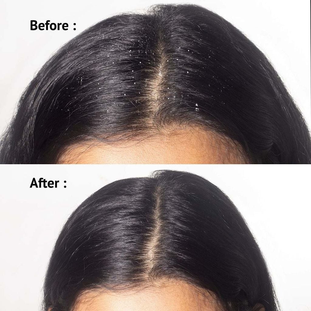 Chọn dầu gội và gội đầu đúng cách giúp tóc sạch thoáng dễ chịu