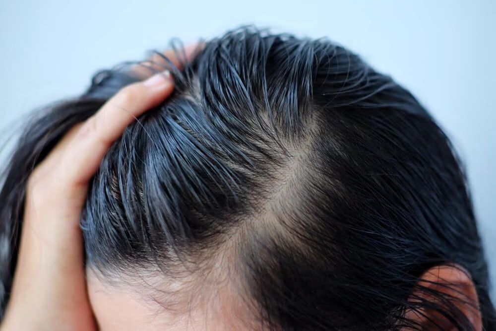 Không nên dùng tay vuốt tóc quá nhiều