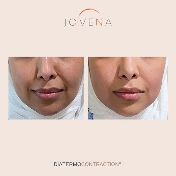 cong-nghe-tre-hoa-da-da-tang-2