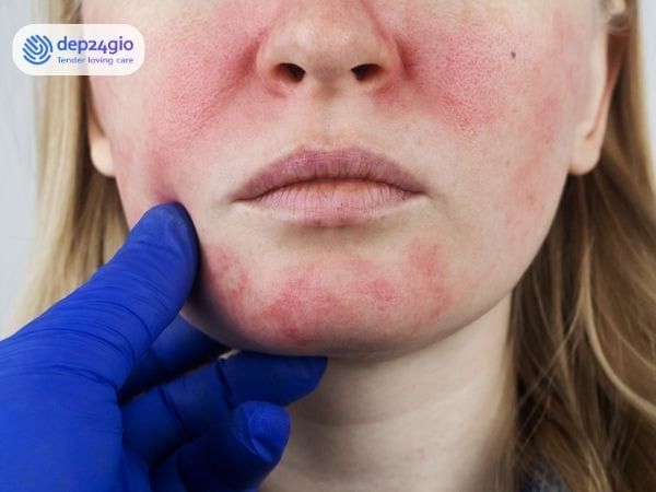 gian-mao-mach-o-mat-2