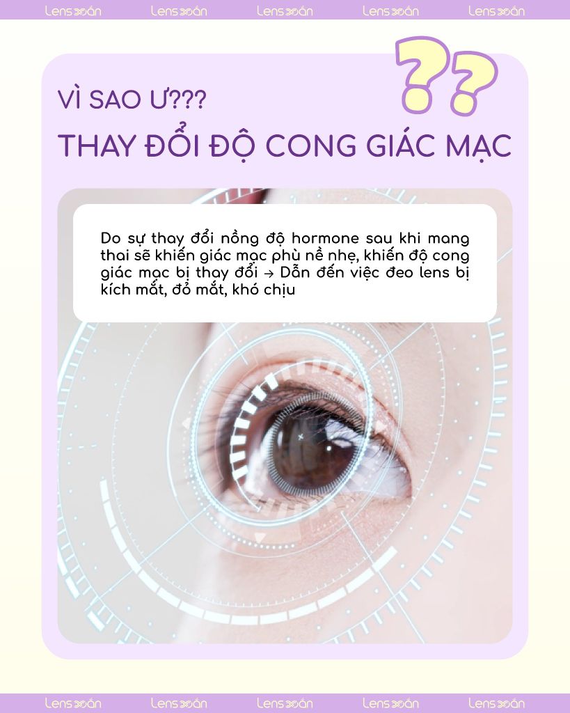 Lens an toàn cho mẹ bầu – Giải pháp cho giác mạc từ Lens Xoắn