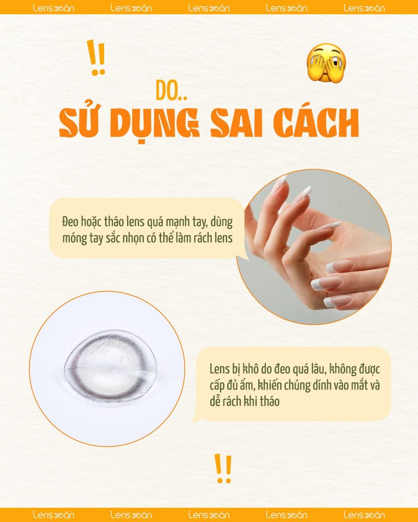 Lens bị rách ngay trong mắt và cách phòng tránh an toàn