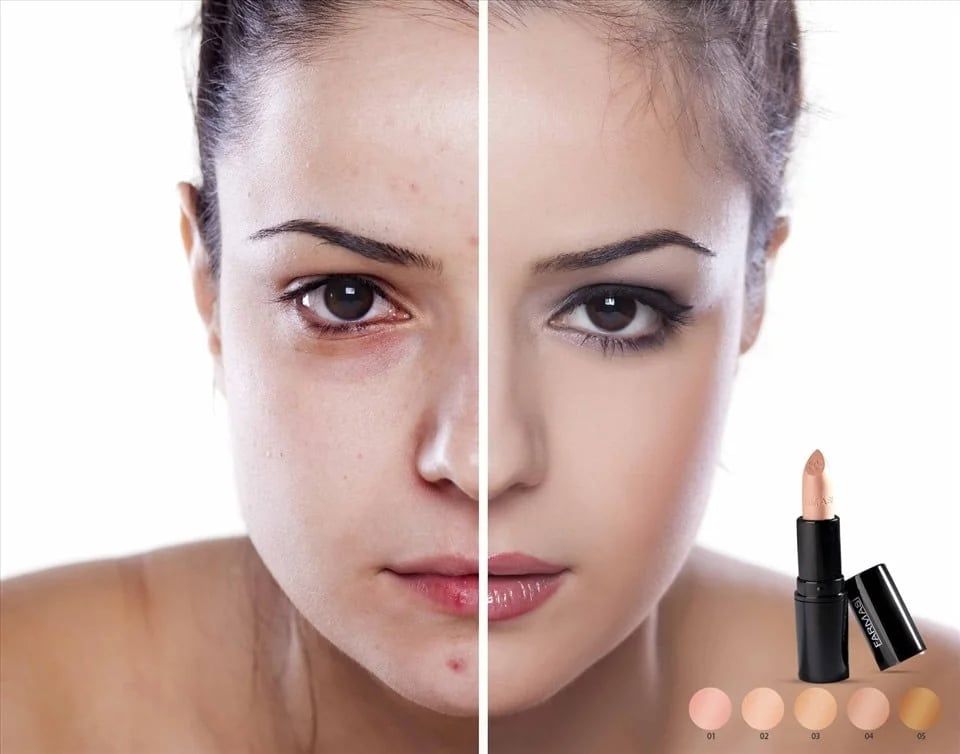 Concealer che quầng thâm mụn