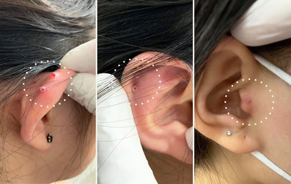 mức độ đau của các vị trí xỏ khuyên