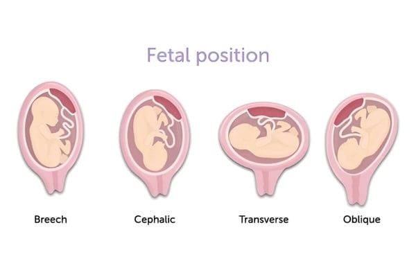 các dạng ngôi thai đầu