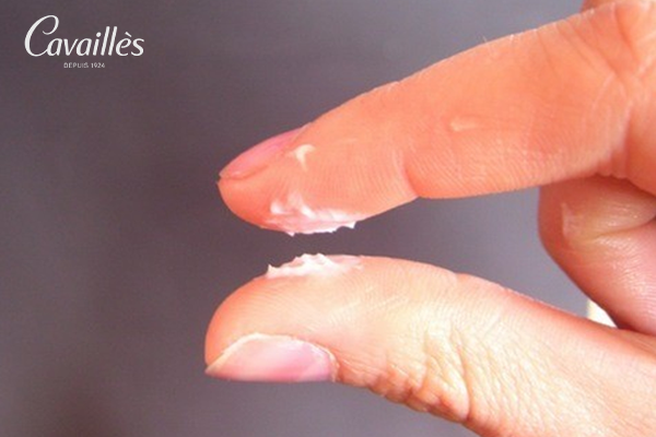 Khí hư bình thường như thế nào? (Khí hư sinh lý)