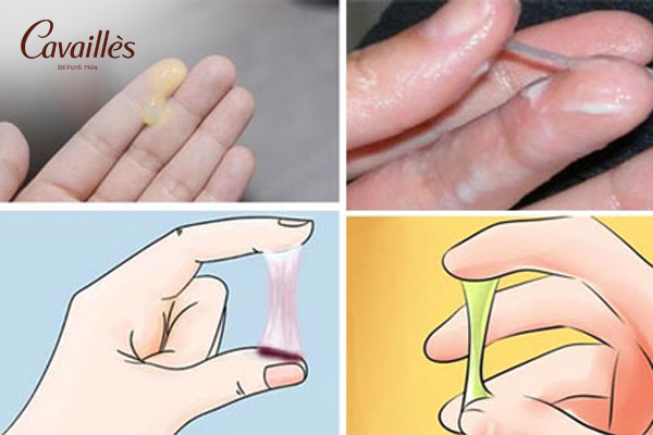 Khí hư là gì? Vai trò của khí hư