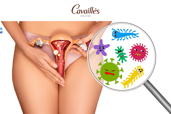 Cách chọn dung dịch vệ sinh