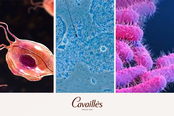 Nguyên nhân bệnh lý gây khí hư màu vàng