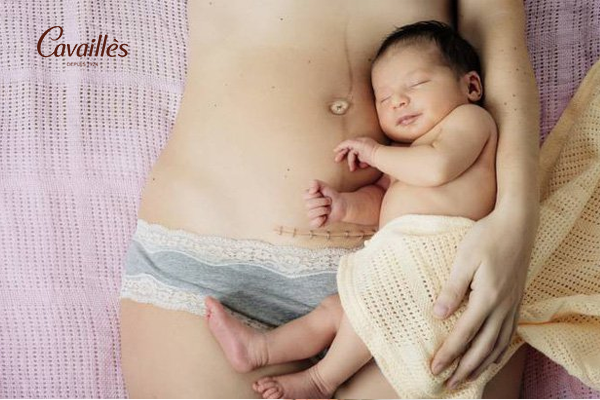 Sau sinh bao lâu thì dùng dung dịch vệ sinh?