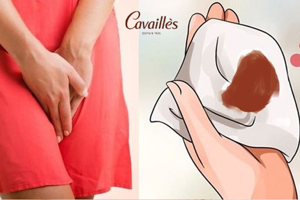 Cách xử lý và chăm sóc tại nhà khi ra khí hư màu nâu