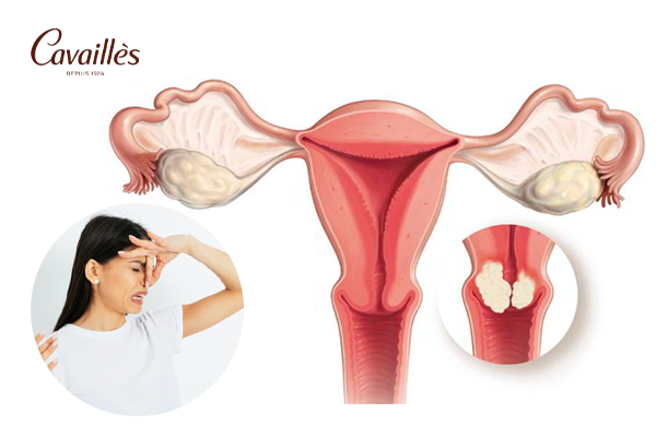 Khi nào vùng kín có mùi chua là bất thường?