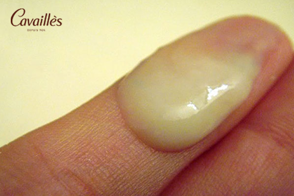 Khí hư màu xanh ở các nhóm đặc biệt