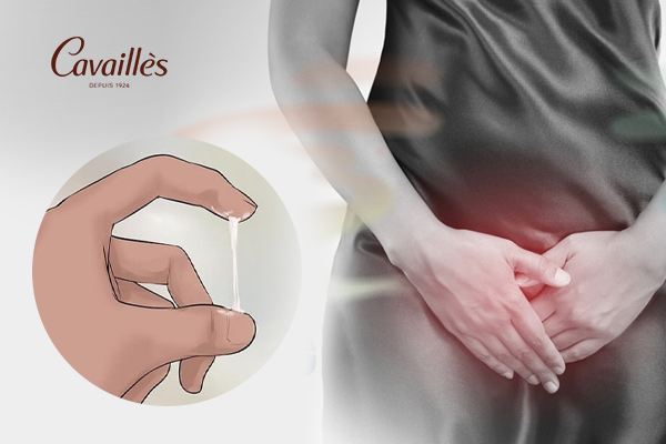 Các dạng khí hư màu trắng thường gặp và ý nghĩa