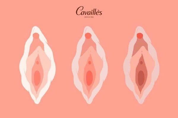 Thay đổi vùng kín sau sinh thường