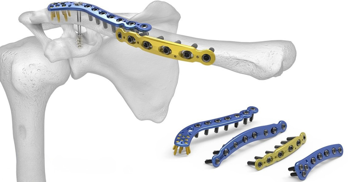 Nhựa PLA là gì? Đặc tính, ứng dụng và so sánh chi tiết trong in 3D Nhựa PLA là gì? Đặc tính, ứng dụng và so sánh chi tiết trong in 3D