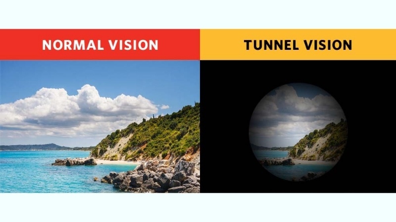 Mờ mắt và thu hẹp vùng nhìn – dấu hiệu của bệnh lý có khả năng gây tổn thương thần kinh thị giác.