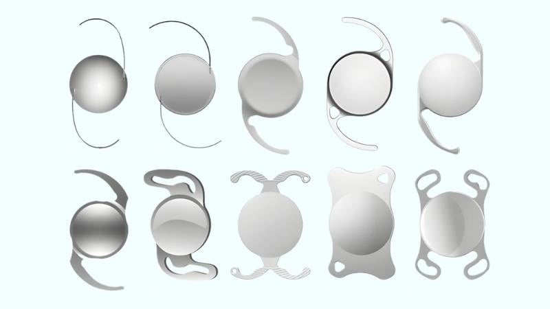 Kỹ thuật treo củng mạc là giải pháp tối ưu giúp bệnh nhân không còn bao thủy tinh thể tìm lại ánh sáng