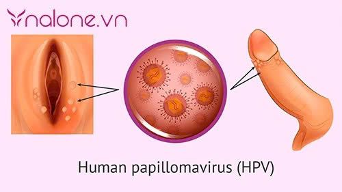 Ngủ chung có lây sùi mào gà không?