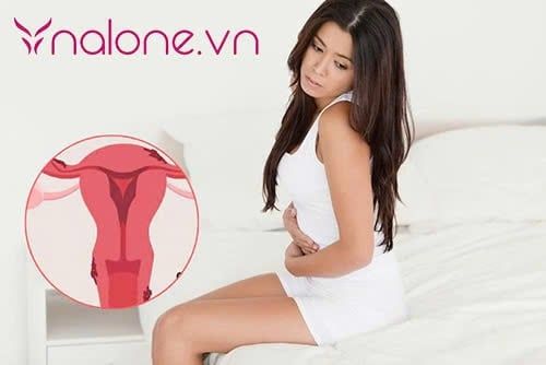 buồn nôn sau khi quan hệ do lạc nội mạc tử cung