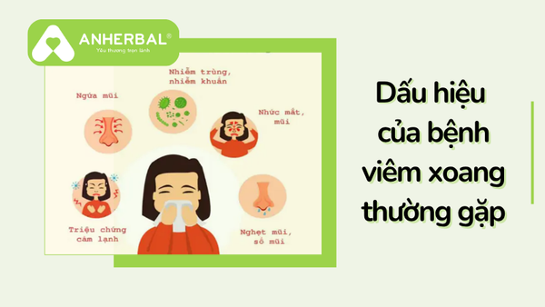 dau hieu cua benh viem xoang