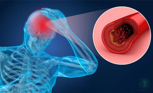 Hình ảnh sản phẩm