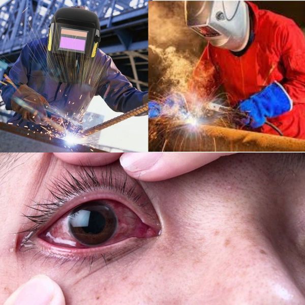 Bảo vệ mắt khi hàn