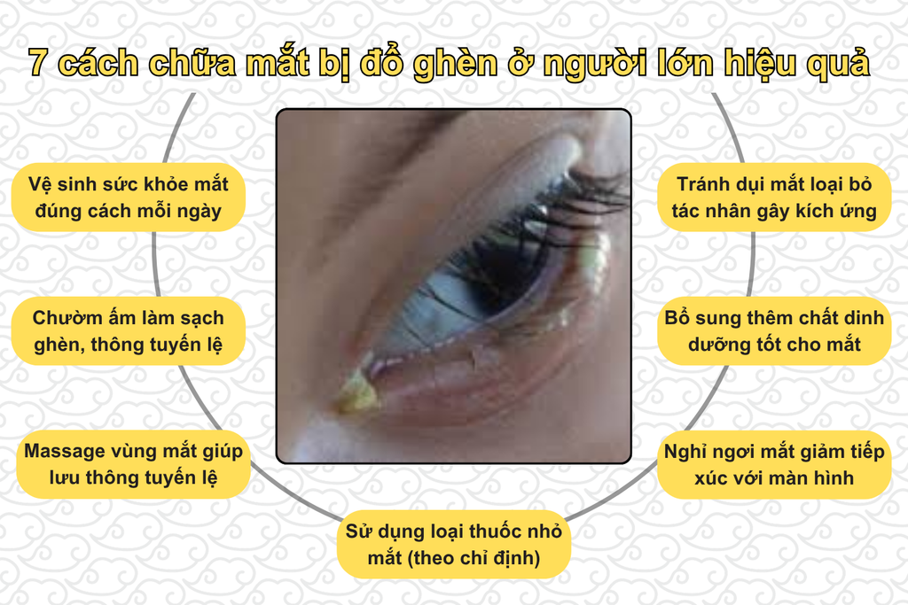7-cach-chua-mat-bi-do-ghen-o-nguoi-lon-hieu-qua