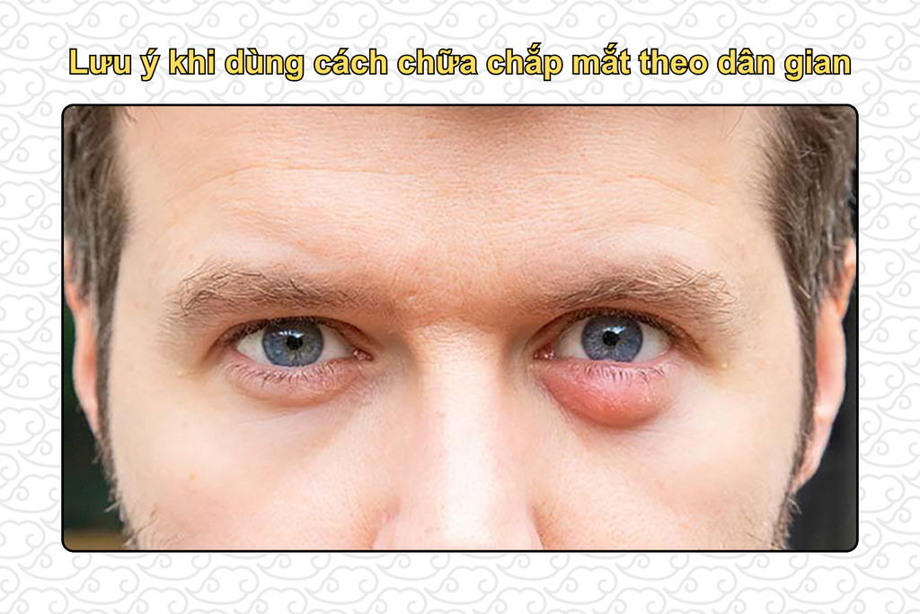 luu-y-khi-dung-cach-chua-chap-mat-theo-dan-gian