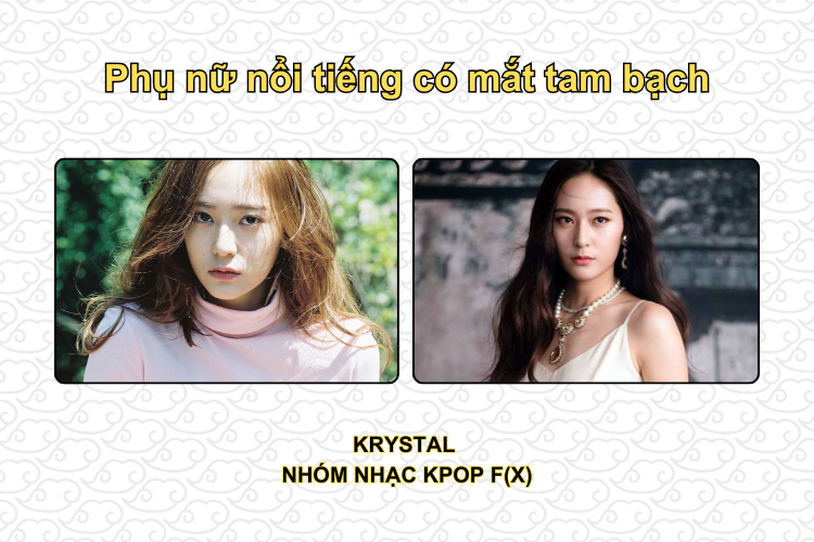 Những người phụ nữ nổi tiếng có mắt tam bạch 2