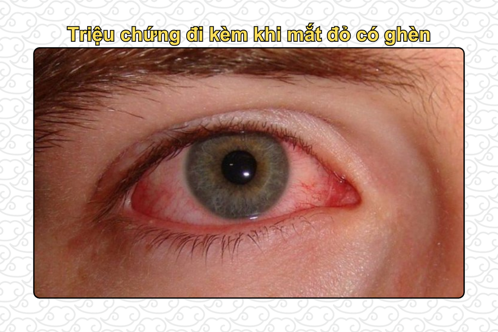trieu-chung-di-kem-khi-mat-do-co-ghen