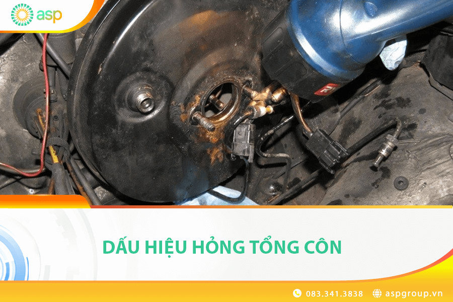 dấu hiệu xe hết côn