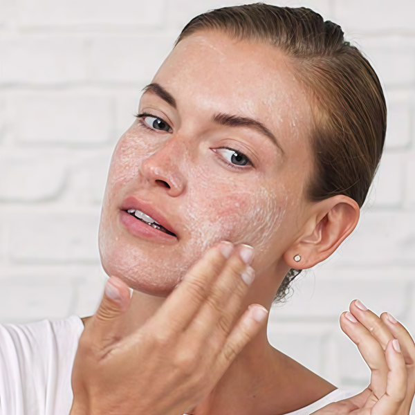 dấu hiệu của da thiếu nước 3