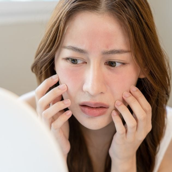 dấu hiệu da bị cháy nắng