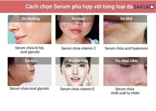 Cách lựa chọn serum phù hợp mang lại hiệu quả cho làn da