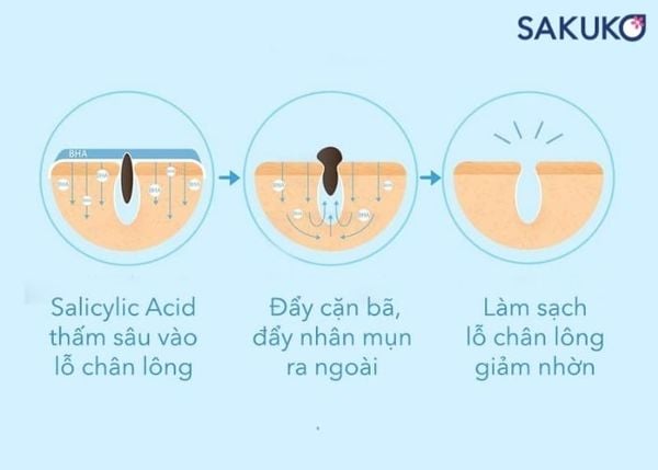 BHA giúp làm sạch sâu lỗ chân lông