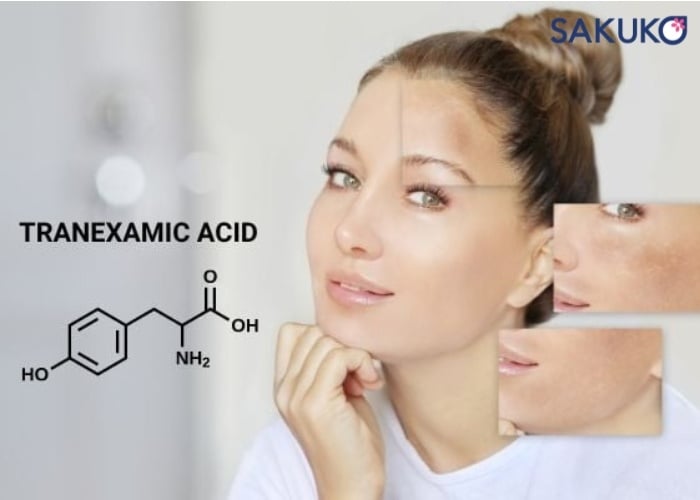 Công dụng của Tranexamic Acid trị nám